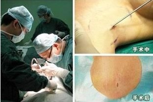 狐臭手术多少钱 团队.jpg